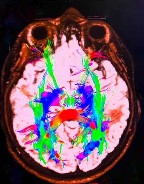 A brain scan showing areas of activation when listening to music, highlighting the amygdala, hippocampus, and auditory cortex.
