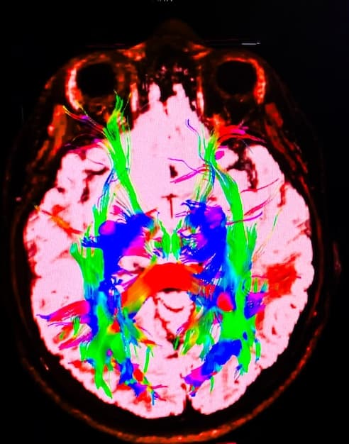 A brain scan image showing activity levels during sleep, highlighting the areas responsible for mood regulation and cognitive function. The image should be colorful and visually engaging.